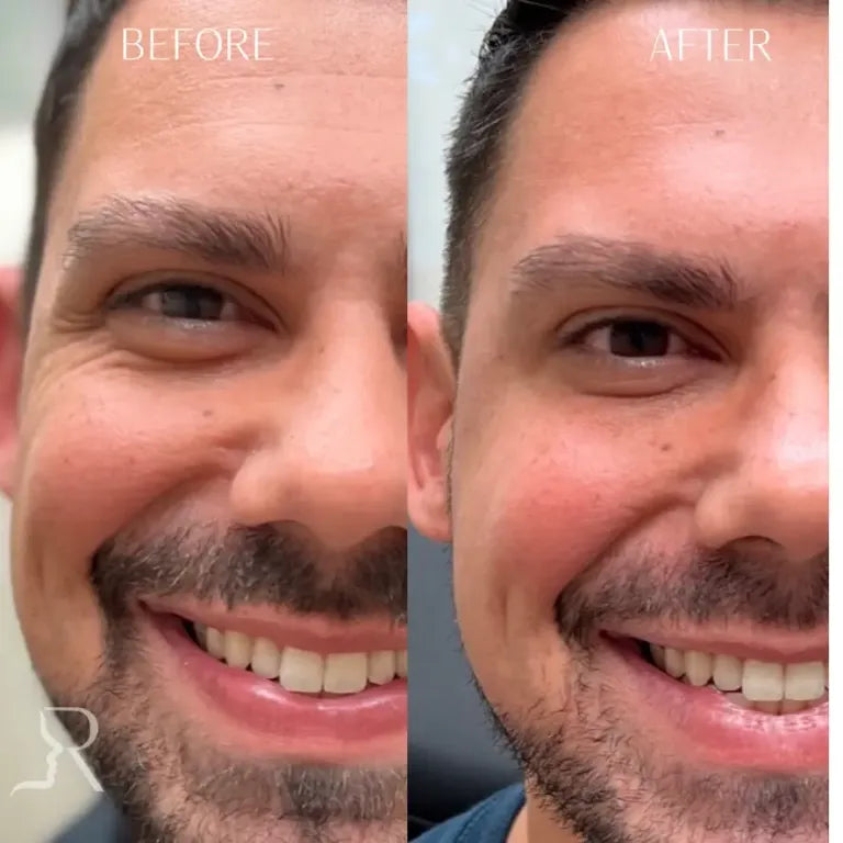 Harry, 37