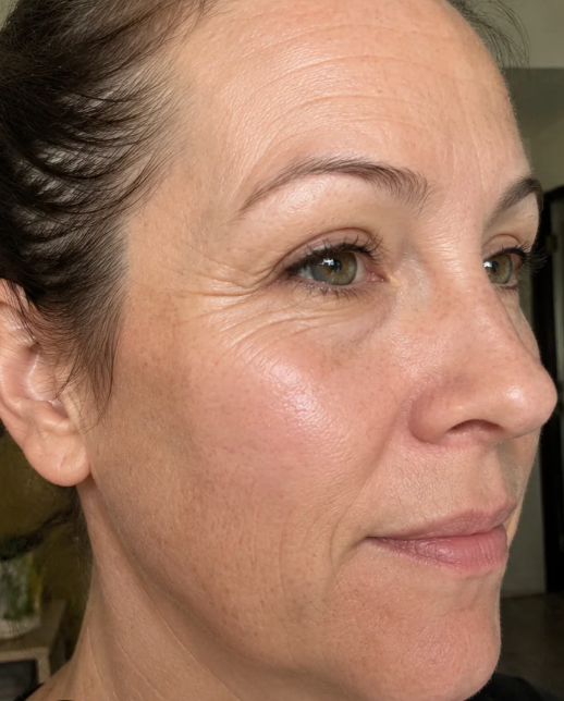Janet S. before