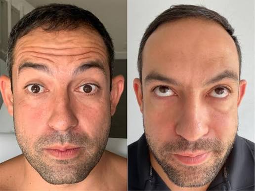 Michael, 40