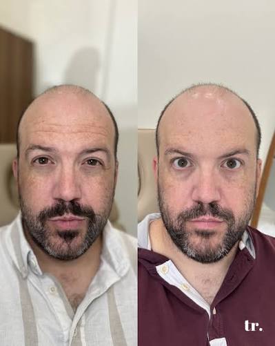 Connor, 38