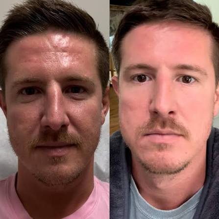 Alex, 35